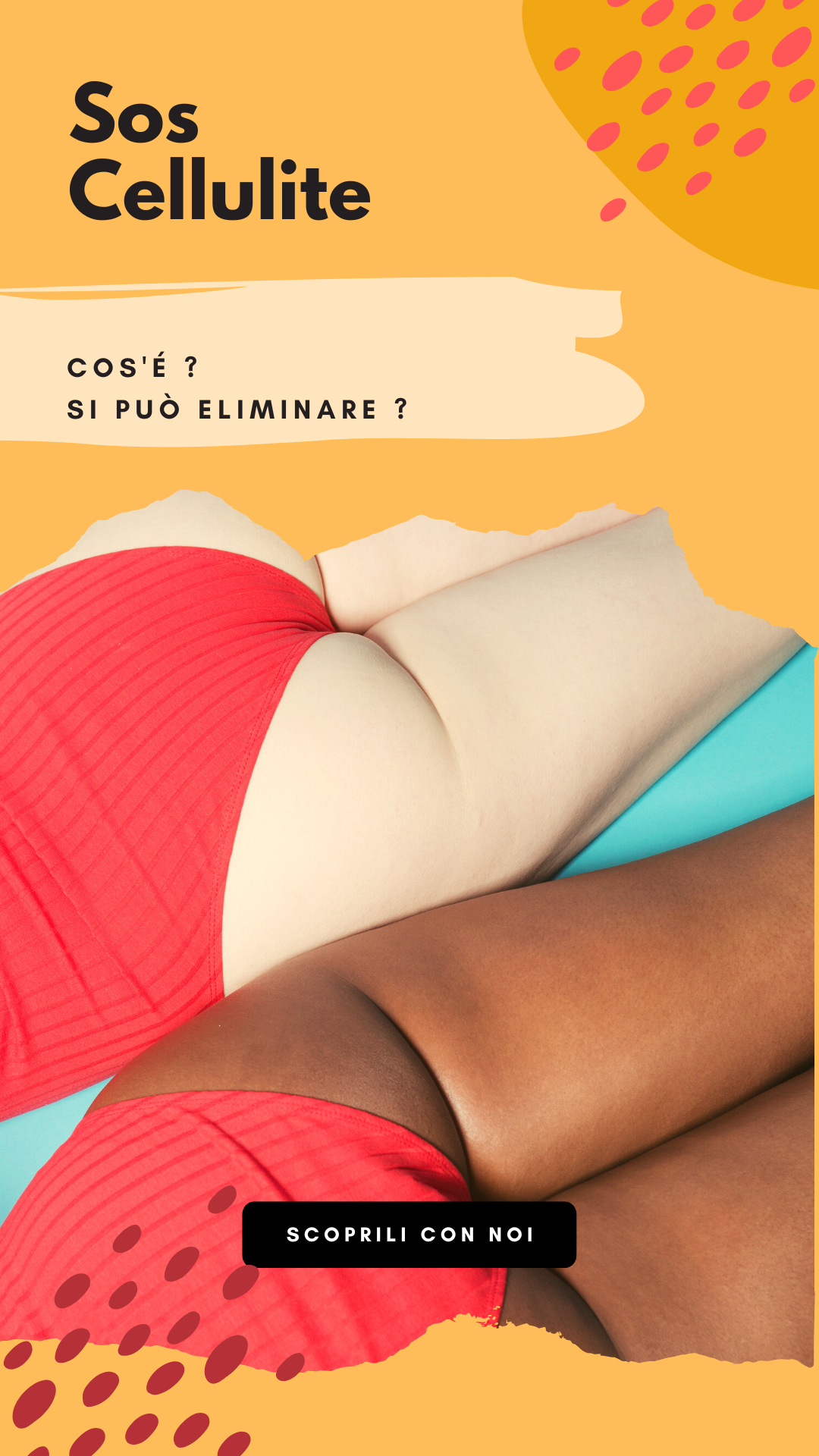 La cellulite Estetica Giusy S.O.S cellulite